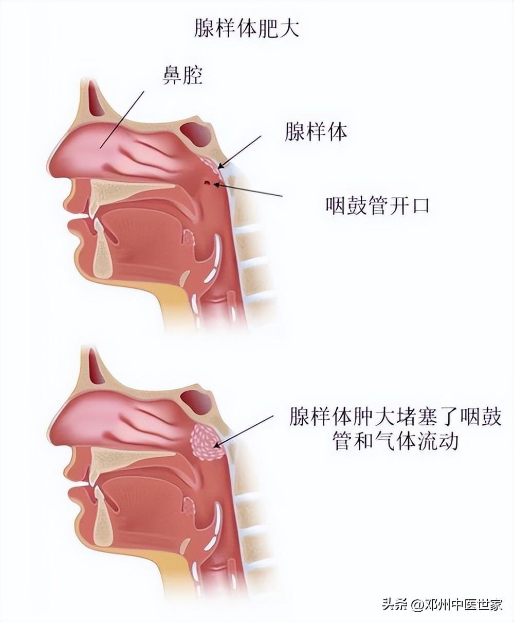 木兰生活床上用品,木兰生活床上用品，打造优质睡眠的舒适之选